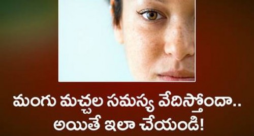 మంగు మచ్చల సమస్య వేదిస్తోందా.. అయితే ఇలా చేయండి!