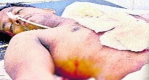 సినిమా లాంటి ఘటన.. 9 కత్తిపోట్లు దిగిన వ్యక్తిని కాపాడిన బస్సు  డ్రైవర్ 