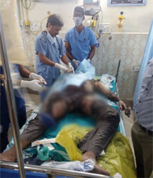 వ్యక్తిపై పెట్రోలుపోసి నిప్పటించిన ఆగంతకుడు