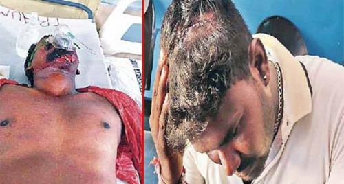 వైఎస్సార్‌సీపీ నాయకులపై టీడీపీ నాయకులు కత్తులతో దాడి.. 