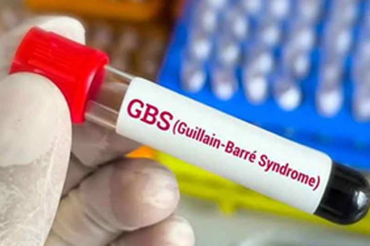 Andhra Pradesh Reports Fifth Death Due to Guillain-Barre Syndrome, Health Dept on High Alert