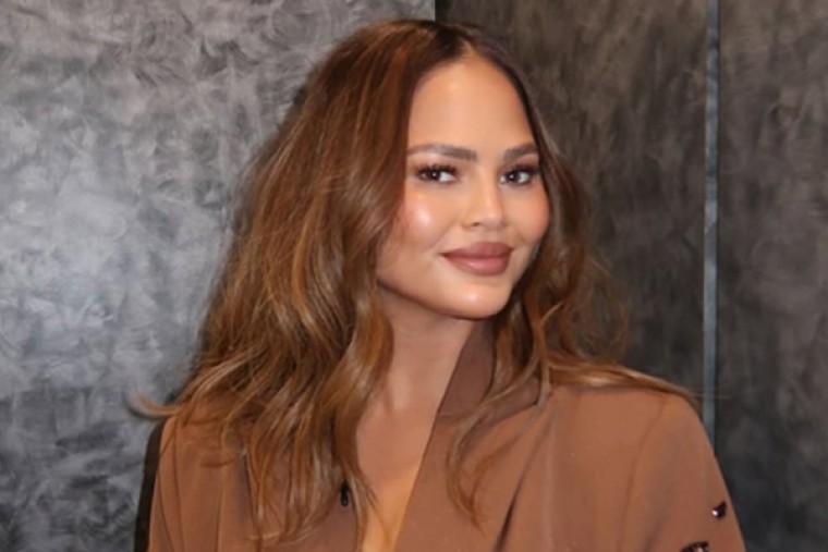Why Chrissy Teigen says she's gonna have the 'worst black eye'?
