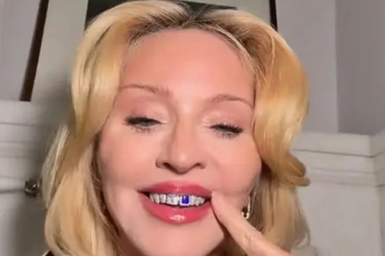 Madonna rocks new shimmery 'mouth jewellery'