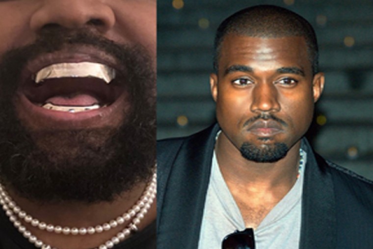 Kanye West replaces teeth with titanium gnashers