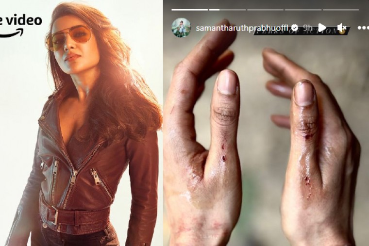 షూటింగ్లో గాయాలు.. సమంత పోస్ట్ వైరల్ 