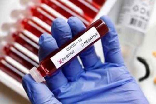 Tourist from Argentina tests Covid positive, goes missing in UP