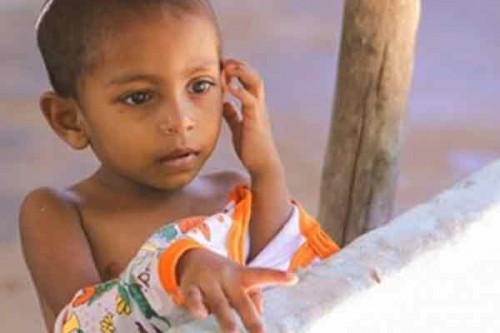 Malnutrition rises among Sri Lankan kids under 5: Health Minister
