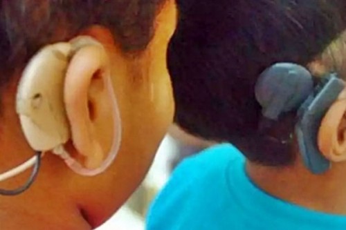 India's orthopaedic, cardiac implant industry to reach $5 billion by FY28