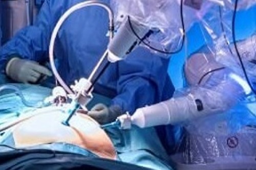 Study reports first steps toward robotic bladder transplantation in humans