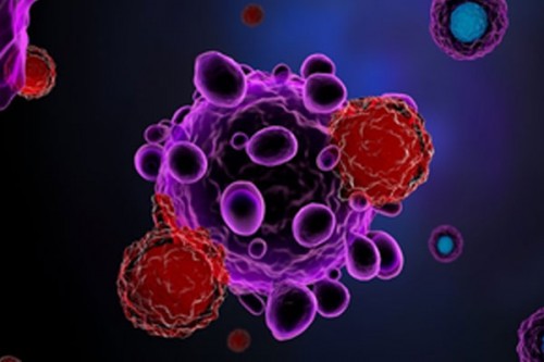 Stem cell therapy safe, and effective in treating Parkinson's disease