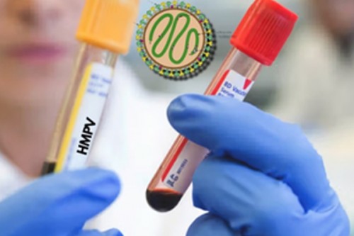 HMPV cases in northern provinces declining: China