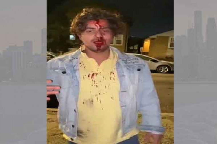 Student from Hyderabad in Chicago injured in attack 