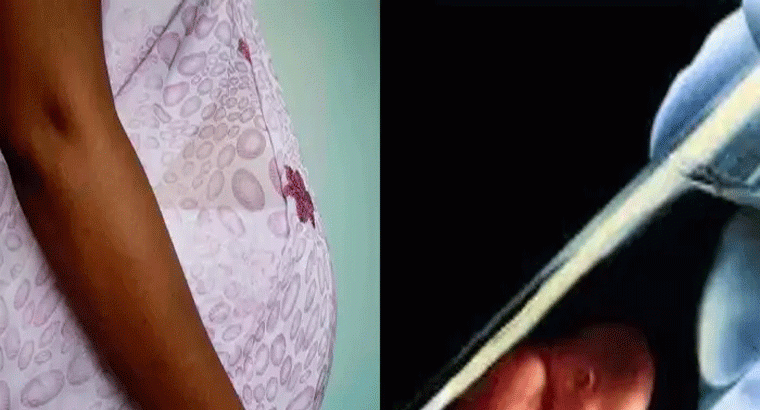 ఆ బిడ్డ ఐవీఎఫ్ ద్వారా పుట్టలేదు.. స్పష్టి కేసులో వెలుగులోకి సంచలన విషయాలు