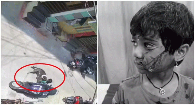 నాలుగేళ్ల చిన్నారిపై వీధి కుక్క దాడి.. ముఖంపై తీవ్ర గాయాలు