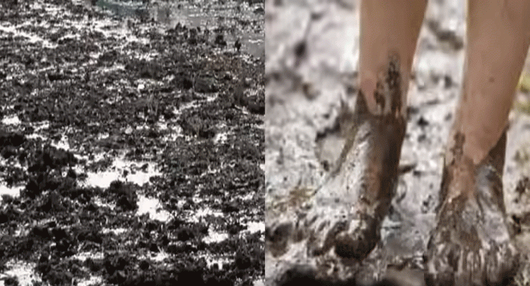 బురదలో తిరిగే వారికి ప్రమాదకర వ్యాధి.. గుర్తించకపోతే ప్రాణాలకే ముప్పు