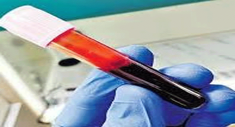 అంగన్‌వాడీ, ప్రభుత్వ పాఠశాలల్లోని విద్యార్థులకు ..ఉచితంగా రక్త పరీక్షలు