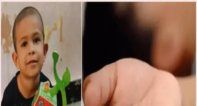 కాలు సర్జరీ వికటించి బాలుడి మృతి,,,వైద్యుల నిర్లక్ష్యంపై తల్లిదండ్రుల ఆందోళన