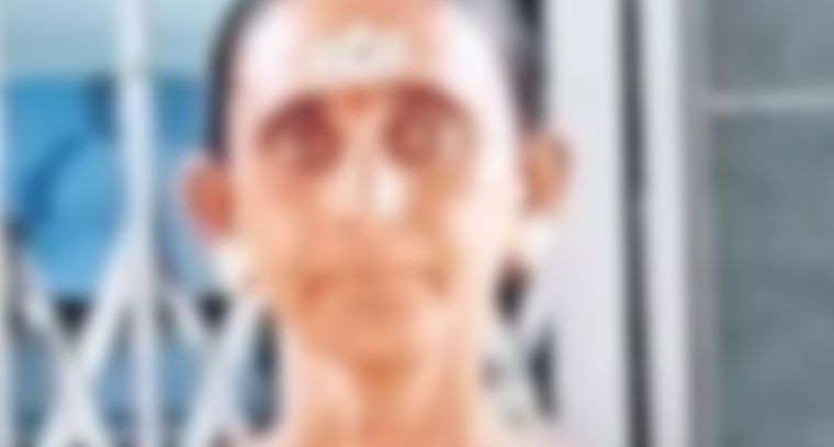 వీడియో కాల్ సాయంతో ఆపరేషన్.. మహిళ మృతి