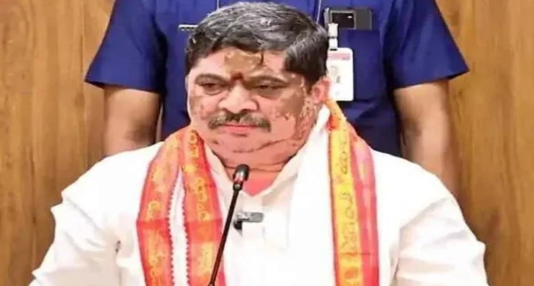 జూబ్లీహిల్స్ ఉప ఎన్నిక.. స్థానిక నేతకే కాంగ్రెస్ టికెట్

