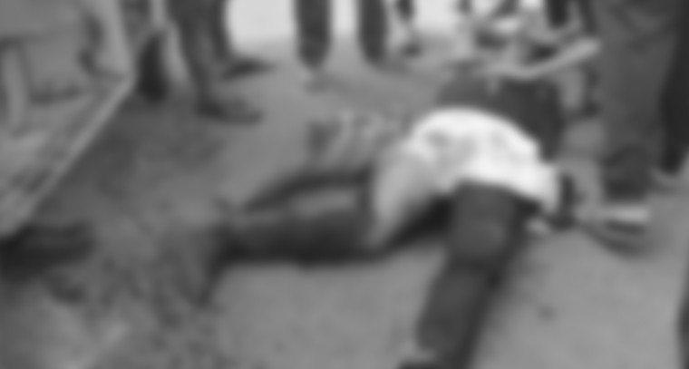 స్కూల్ ఆటో బోల్తా.. విరిగిన విద్యార్థి కాలు