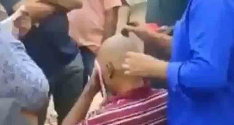 బట్టతలకి జుట్టు తెప్పిస్తామని మోసానికి పాల్పడుతున్న ఢిల్లీ ముఠా