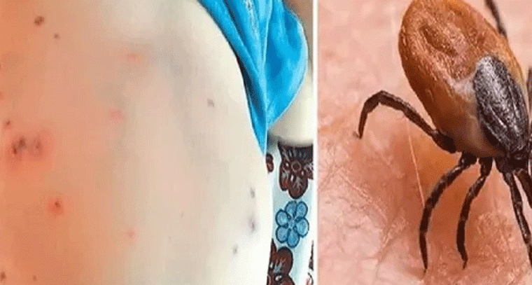 హైదరాబాద్‌‌లో విస్తరిస్తున్న ప్రాణాంతక వ్యాధి