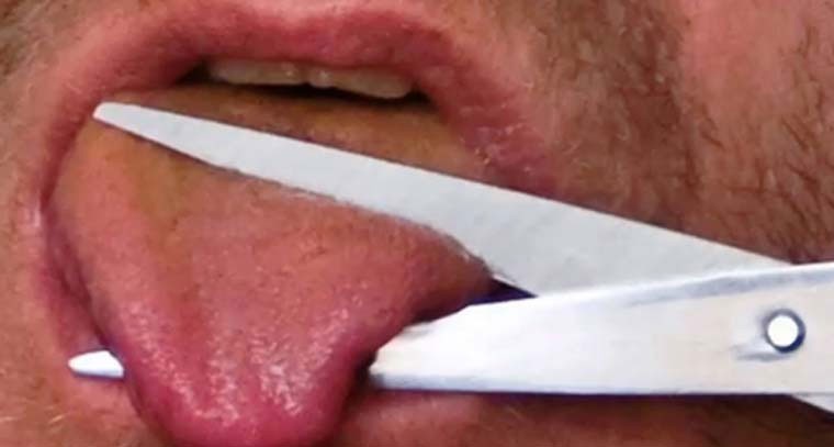 మానవత్వాన్ని మరిచిన కొడుకు - తండ్రి నాలుక కోసిన ఘటన.. 